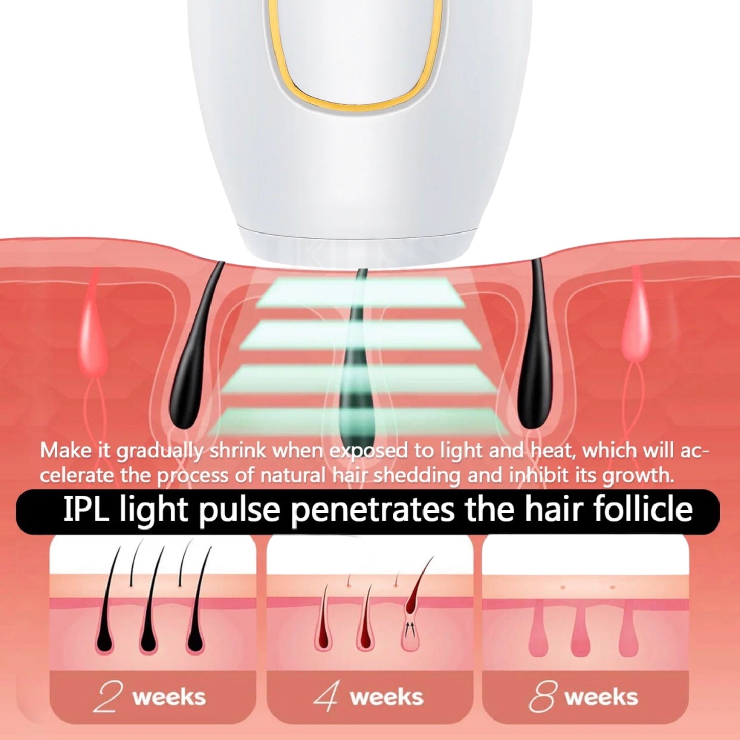 IPL pro laser hair removal kit